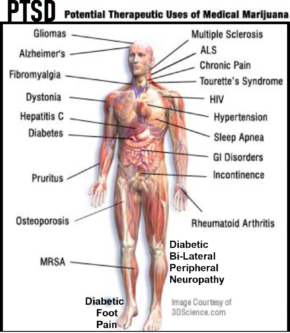 Potential Therapeutic Uses of Medical Marijuana